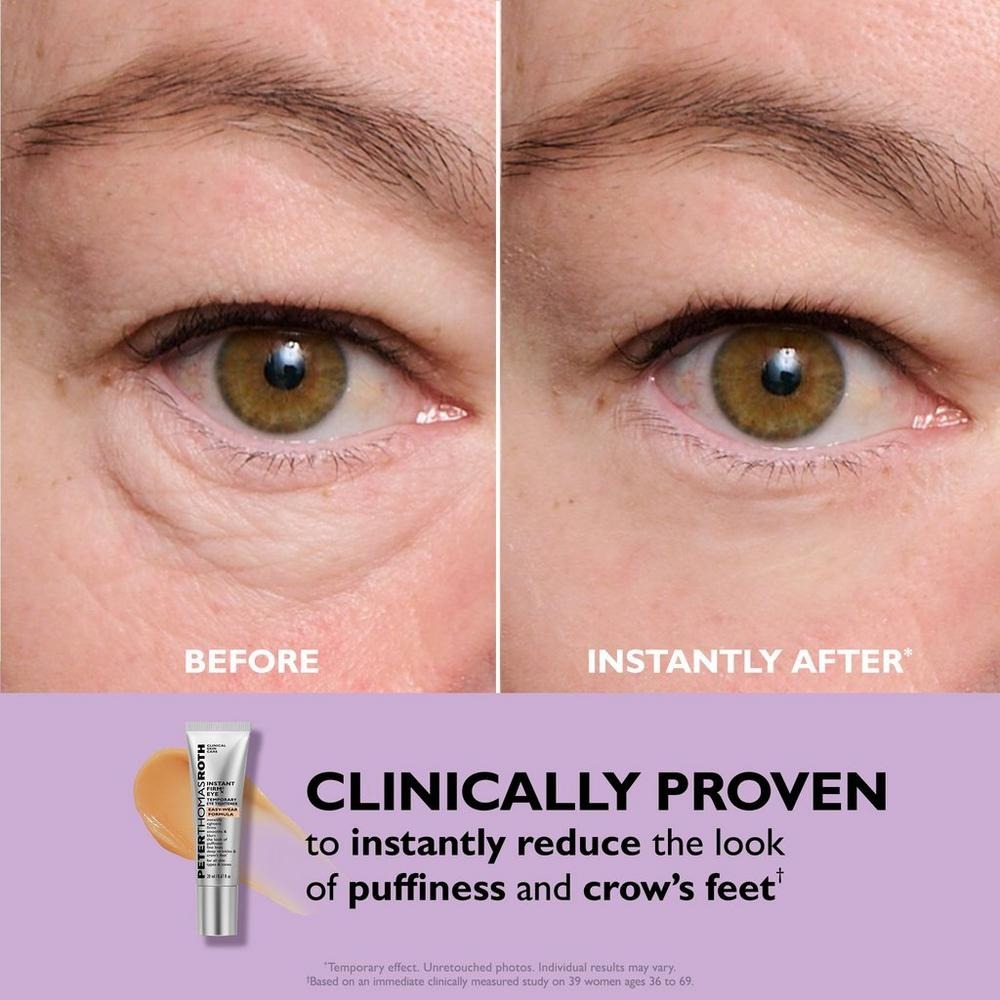 Easy-Wear FirmX Eye Tightener