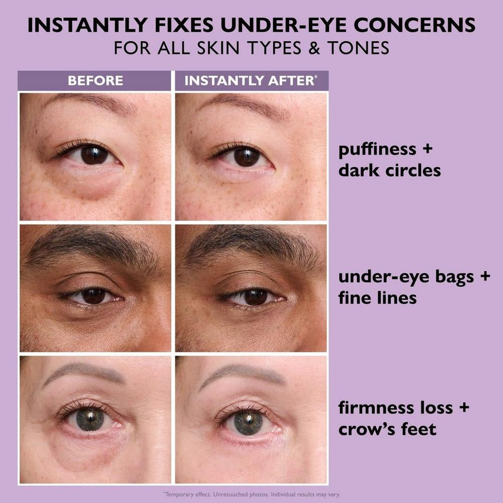 Easy-Wear FirmX Eye Tightener